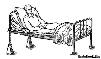 Положение больного в постели на спине