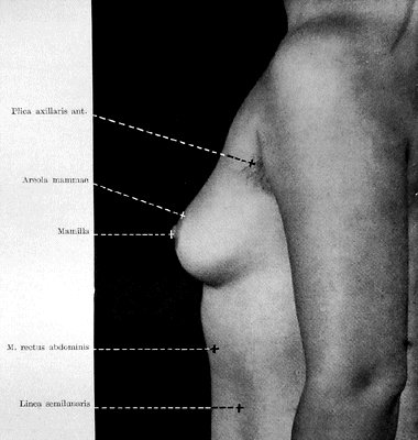 Женская грудная железа при виде сбоку