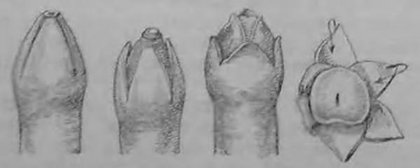 Обрезание по Тобиашеку: видно расположение лоскутов на наружном и внутреннем листке крайней плоти