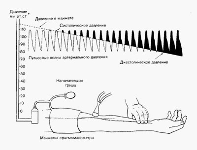 Методика сфигмоманометрии для измерения артериального давления