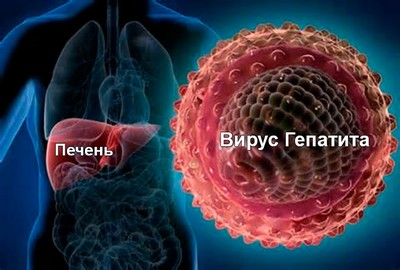 Острый вирусный гепатит причина люпоидного гепатита