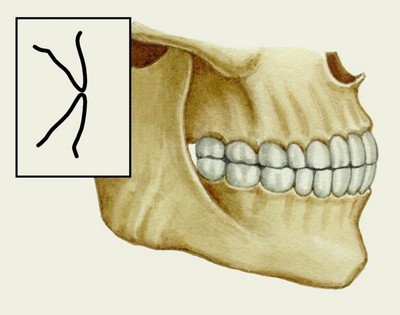 Прямой прикус - фронтальные зубы соприкасаются непосредственно режущими краями