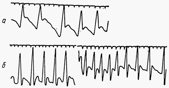 Форма пульсовой волны бедренной артерии собаки