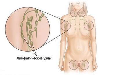Лимфатические узлы молочной железы