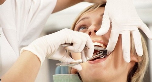 Оперативное удаление корней верхний фронтальных зубов