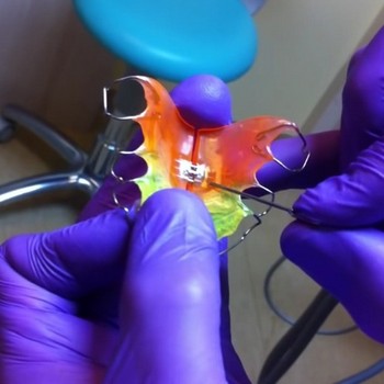 Изготовление ортодонтического аппарата для регуляции прикуса