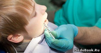 Анестезия моляров в стоматологии