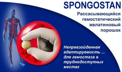 Гемостатический порошок «Спонгостан» для лечения кровотечения из геморроидальных узлов
