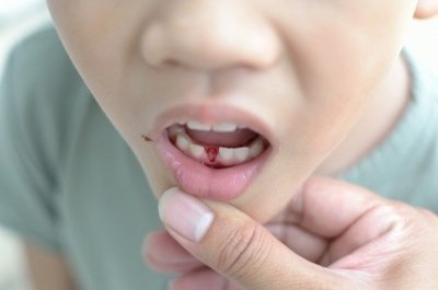 Здоровые молочные зубы у ребенка