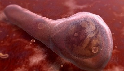 Клостридия - убийца раковых клеток