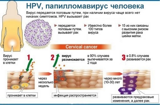 ВПЧ - вирус папилломы человека