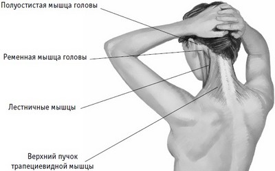 Головные боли напряжения связаны с перенапряжением мышц шеи