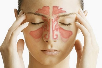 Головные боли из-за воспаления носовых пазух