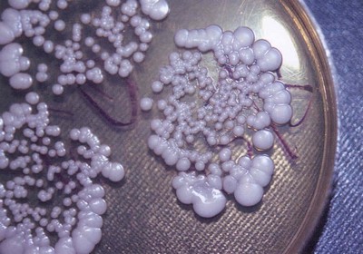 Молочницу у мужчин вызывает тот же микроорганизм, что и у женщин - гриб рода Кандида