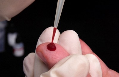 Общий анализ крови на анемию