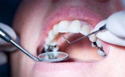 Правильная подготовка зубов к пломбированию современными композитами
