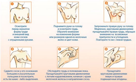 Самообследование груди