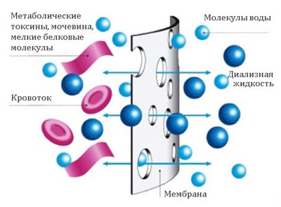 Принцип диффузии при проведении гемодиализа