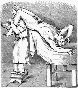 Иллюстрация Willy Meyer положения Тренделенбурга в журнале «Archiv für Chirurgie» за 1885 год