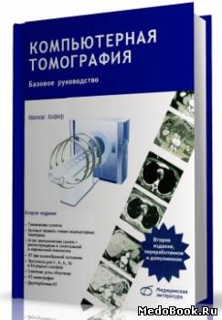 Скачать бесплатно книгу, учебник по медицине Компьютерная томография, М. Хофер, 2008 г.