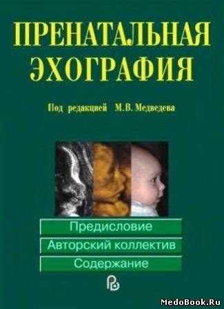 Скачать бесплатно книгу, учебник по медицине Пренатальная эхография, М.В. Медведев, 2005 г.