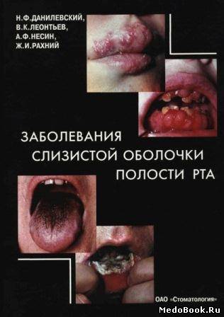 Скачать бесплатно книгу, учебник по медицине Заболевания слизистой полости рта: Атлас, Данилевский Н.Ф., 2001 г.