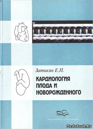 Скачать бесплатно книгу Кардиология плода и новорожденного, Затикян Е.П. 1996 г.