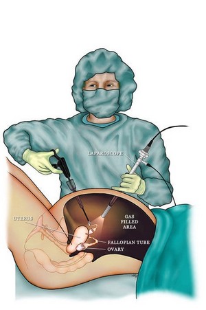 Скачать бесплатно книгу, учебник по медицине Оперативная гинекология: что это?