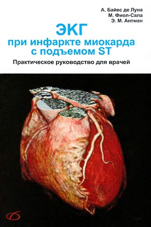 Скачать бесплатно книгу ЭКГ при инфаркте миокарда с подъемом ST, Байес де Луна А., 2009 г.