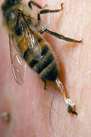 Скачать бесплатно книгу, учебник по медицине Аллергия на укусы насекомых (инсектная аллергия)