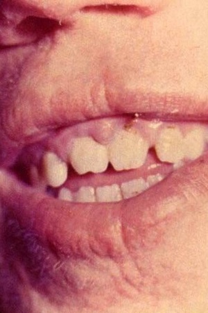 Скачать бесплатно книгу, учебник по медицине Классификация дистрофий зубной системы по Агапову