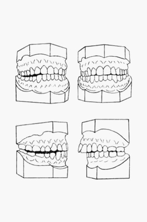 Скачать бесплатно книгу, учебник по медицине Классификация аномалий артикуляции зубов по Агапову