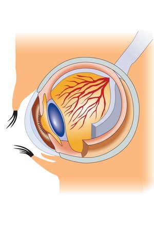Скачать бесплатно книгу, учебник по медицине Инфекционные болезни глаз - офтальмия и трахома