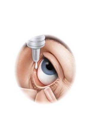 Скачать бесплатно книгу, учебник по медицине Эффективные глазные капли от коньюктивита
