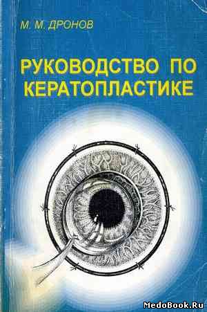 Скачать бесплатно книгу Руководство по кератопластике, М.М. Дронов, 1997 г.