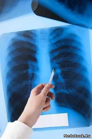 Скачать бесплатно книгу, учебник по медицине К вопросу пересмотра понятия очага туберкулезной инфекции