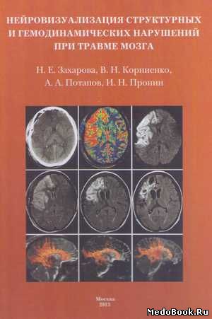 Скачать бесплатно книгу Нейровизуализация структурных и гемодинамических нарушений при травме мозга, Н.Е. Захарова, 2013 г.