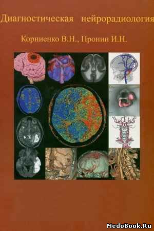 Скачать бесплатно книгу Диагностическая нейрорадиология, В.Н. Корниенко, 2006 г.