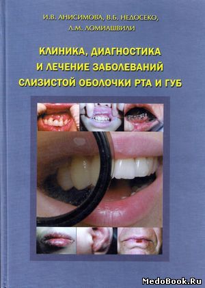 Скачать бесплатно книгу Клиника, диагностика и лечение заболеваний слизистой оболочки рта и губ, И.В. Анисимова, 2008 г.