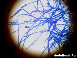 Грибок рода Microsporum - возбудитель микроспории (стригущего лишая)