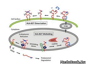 Экспрессия гена HLA-B27 - главного маркера болезни Бехтерева