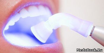 Благодаря своим преимуществам лазерное отбеливание зубов является гораздо более эффективной методикой по сравнению с остальными
