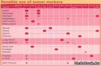 Анализ на опухолевые маркеры (онкомаркеры)