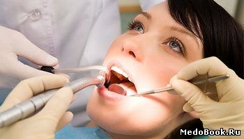 Биокалекс при пломбировании зубов