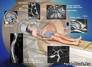 Магнитно-резонансная томография - МРТ